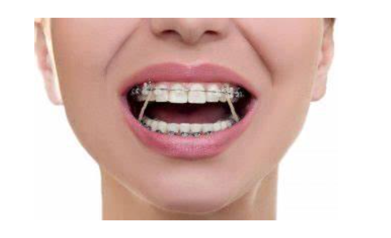 Low Cost Dental Implants